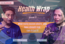 Watch: What really causes ulcers — and how a breath test can detect it
