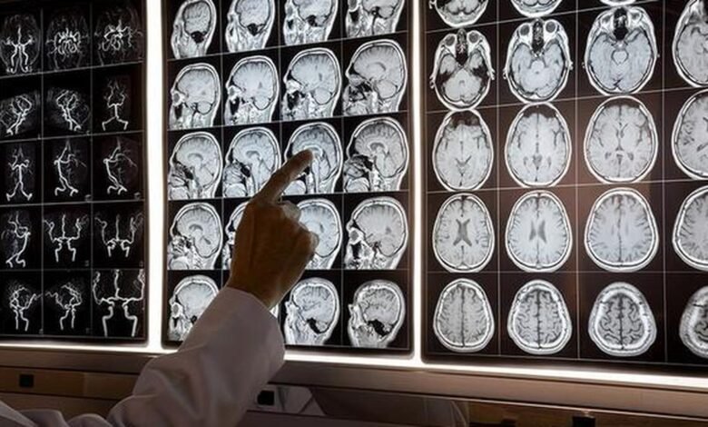 ब्रेन फॉग क्या है और कब इसकी जांच जरूरी होती है