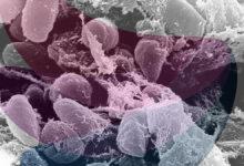 Diseases that changed history