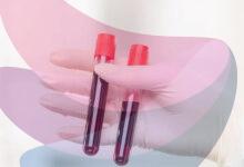 World’s rarest hybrid blood type discovered in Thailand: Study found in just 3 people out of a massive research of 544,000 samples