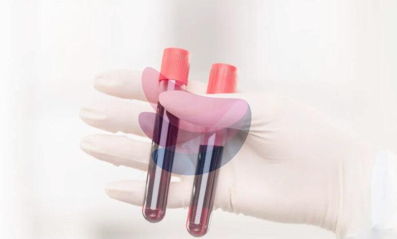 World’s rarest hybrid blood type discovered in Thailand: Study found in just 3 people out of a massive research of 544,000 samples
