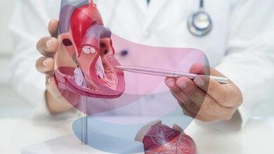 Non-communicable diseases accounted for 60% of all deaths in 2022-2024 | Data