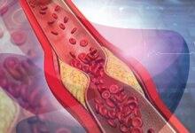 Why the cholesterol debate is about much more than ‘good’ vs. ‘bad’