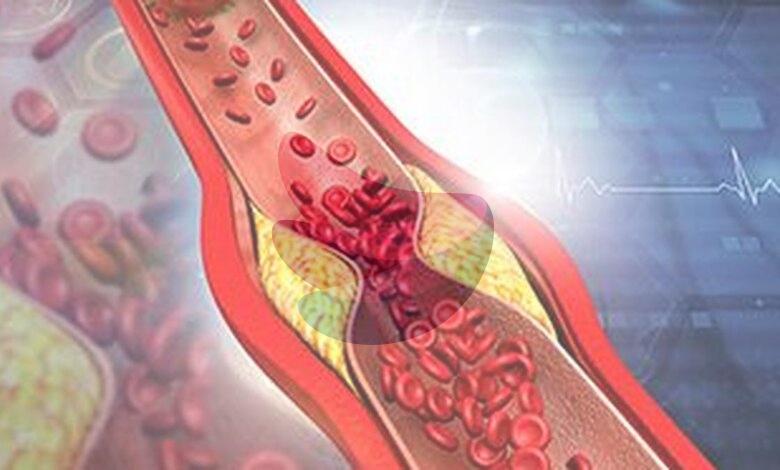 Why the cholesterol debate is about much more than ‘good’ vs. ‘bad’