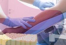 All you need to know about: haemophilia