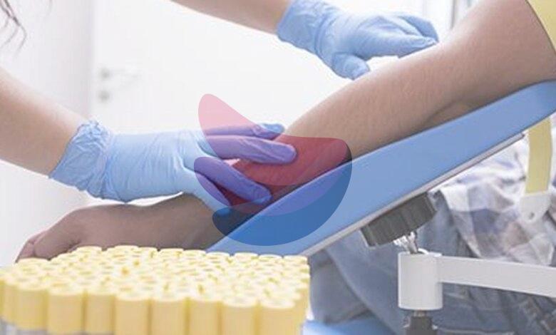 All you need to know about: haemophilia