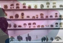 IISc’s Centre for Brain Research launches ₹2 crore AI challenge for early detection of cognitive decline