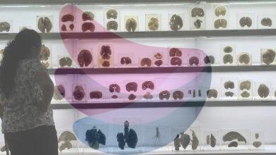 IISc’s Centre for Brain Research launches ₹2 crore AI challenge for early detection of cognitive decline