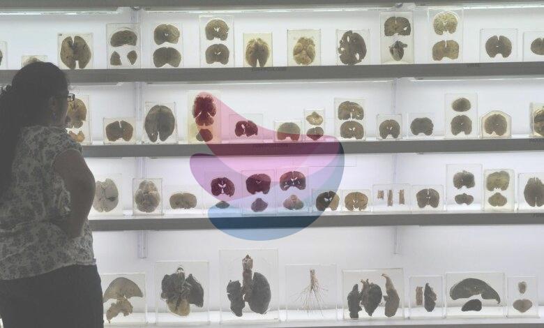 IISc’s Centre for Brain Research launches ₹2 crore AI challenge for early detection of cognitive decline